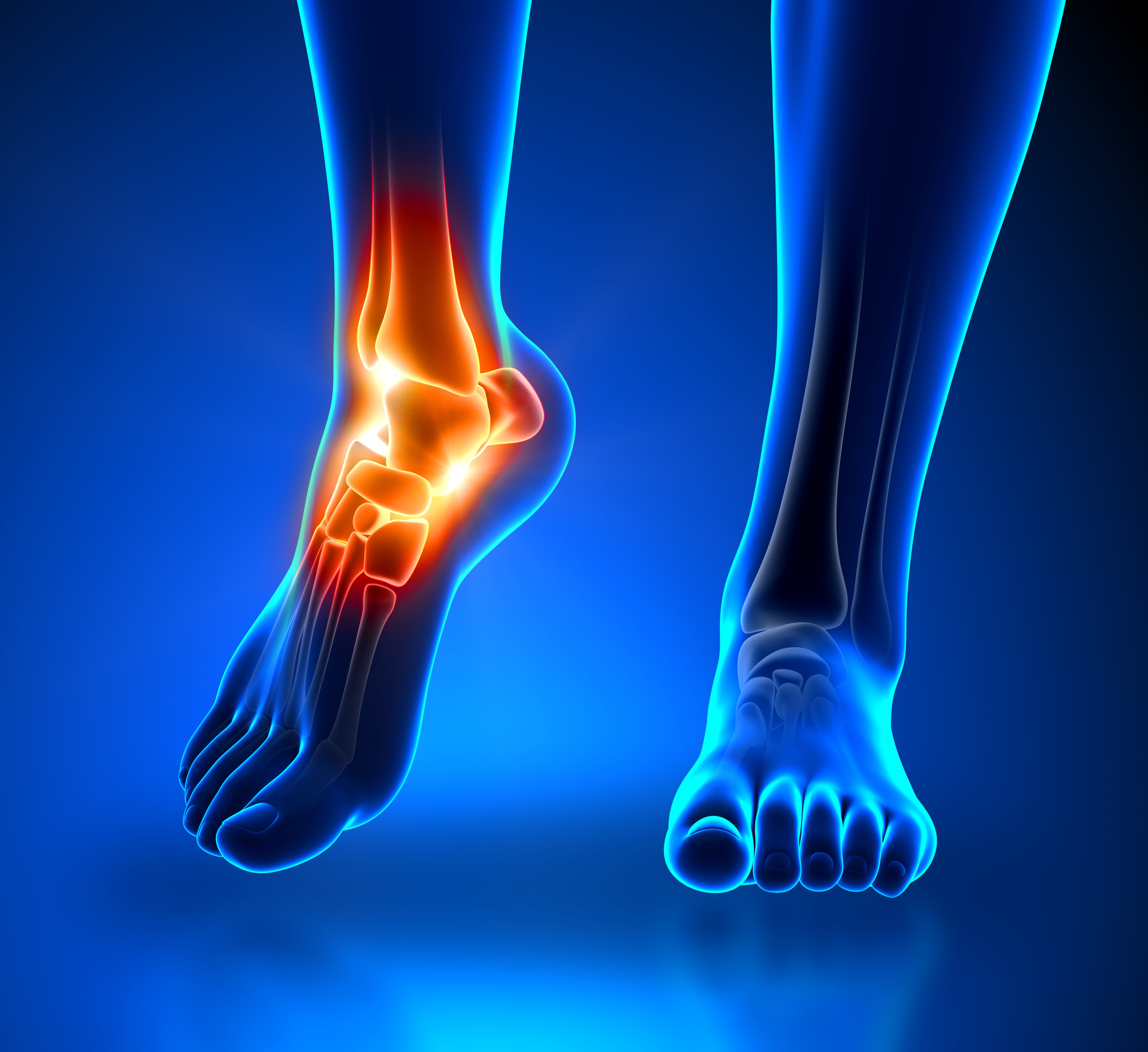 Instabilitatea ligamentelor piciorului și gleznei | Ottobock RO