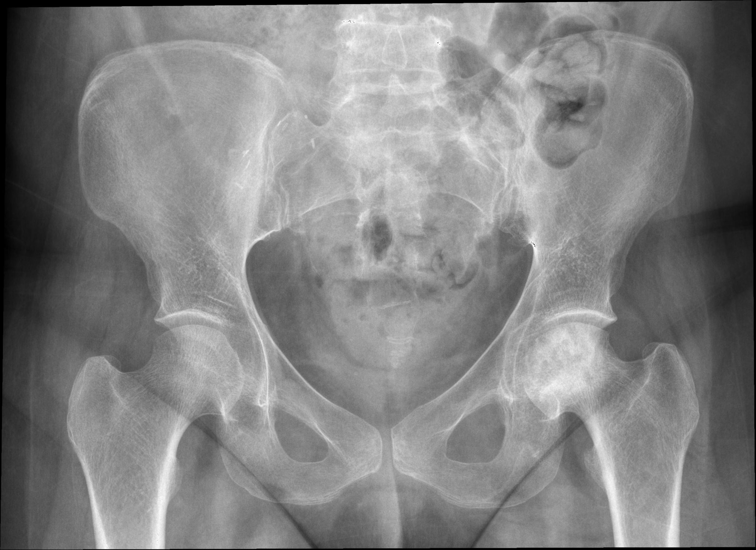 coloana vertebrală și site ul bolilor articulare artroza deformantă a tratamentului medicamentos pentru genunchi