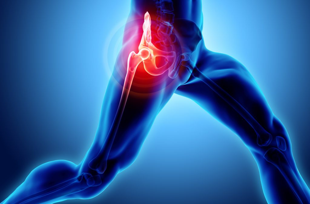 durere în genunchii articulațiilor șoldului exercițiu pentru tratamentul artrozei genunchiului