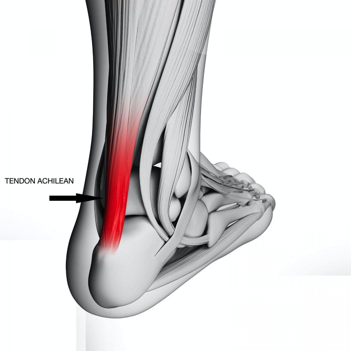 tendoanele piciorului tratează artroza cu ulei de chimen negru
